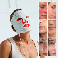 Inside the Omnilux Contour Face Clinical Study: What Research Reveals About LED Light Therapy for Wrinkles
