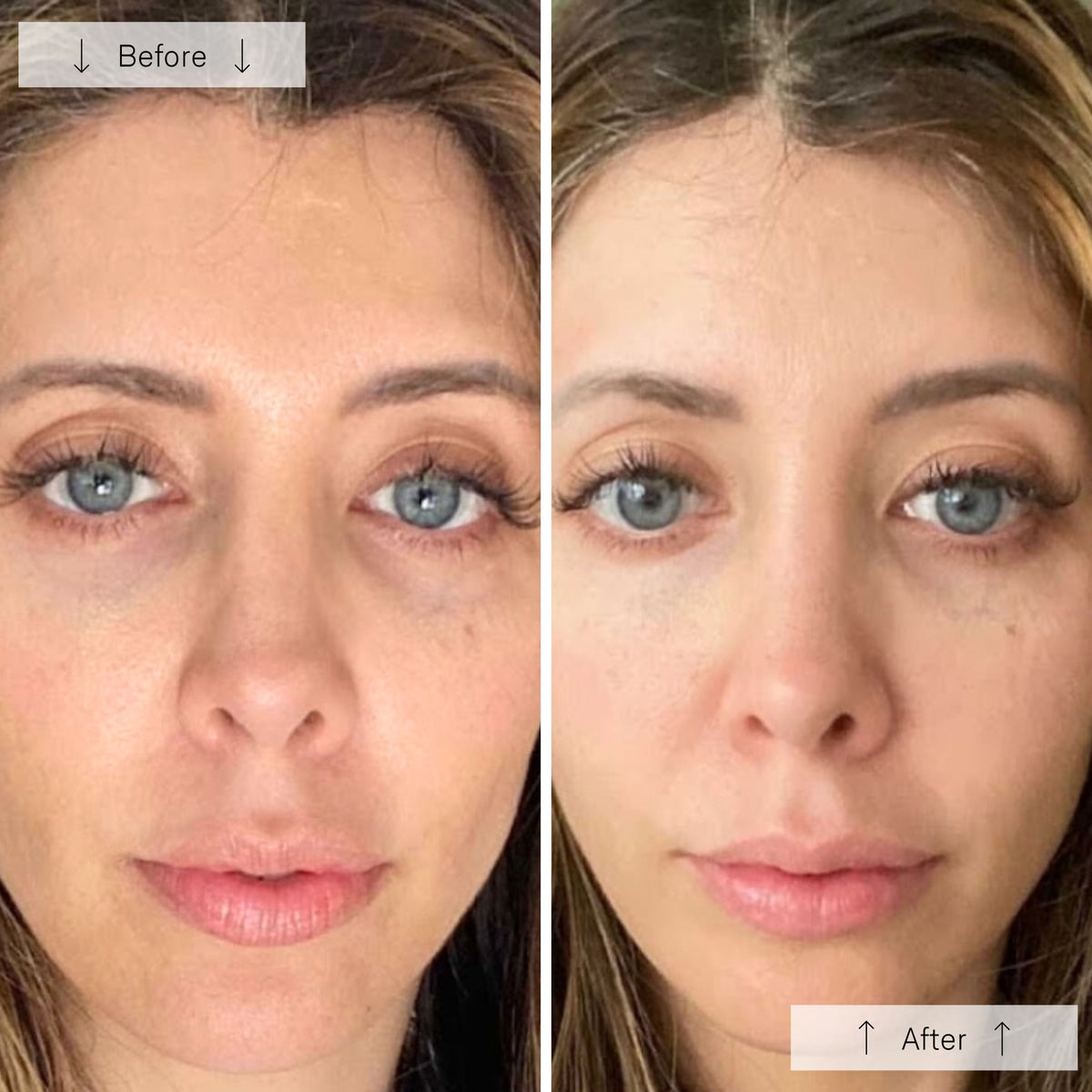 Omnilux Contour Face LED-Lichttherapiemaske – Anti-Aging Für Zuhause Mit FDA-Zulassung