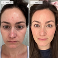 before-afters