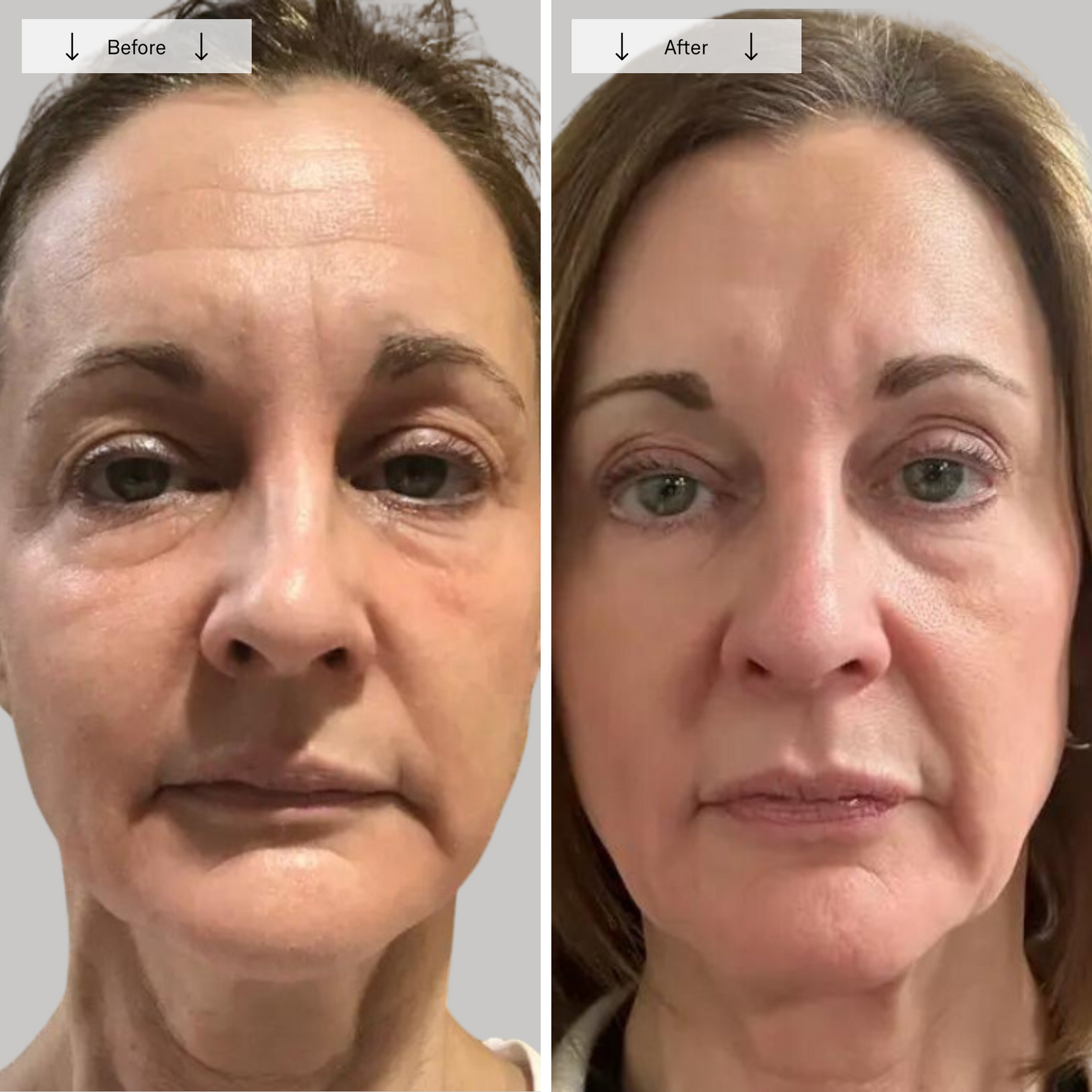 before-afters