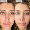 before-afters