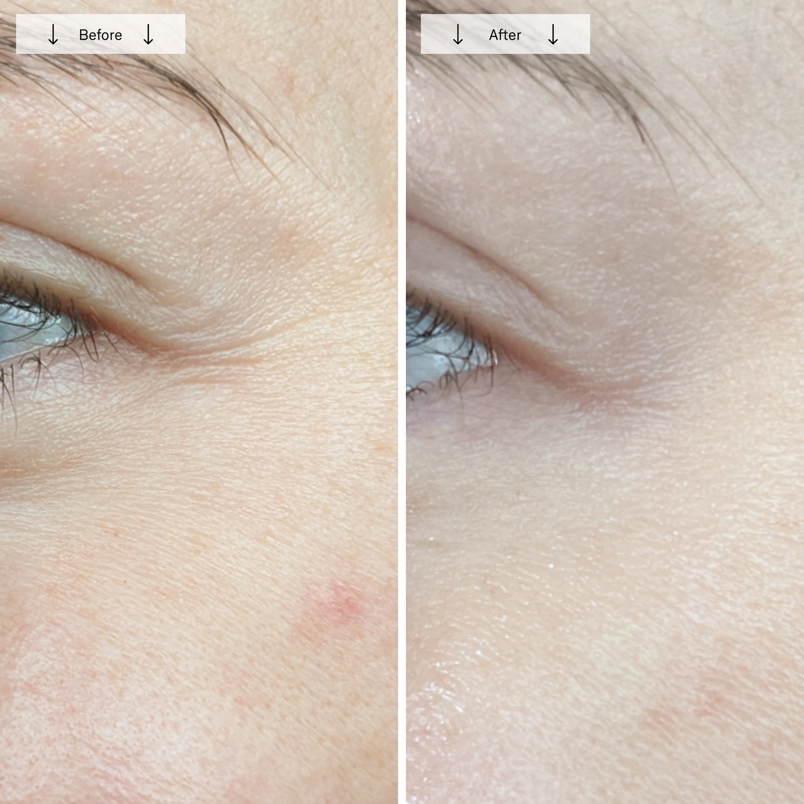 before-afters