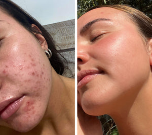 Real skin, real results