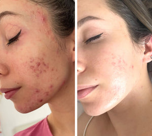 Real skin, real results